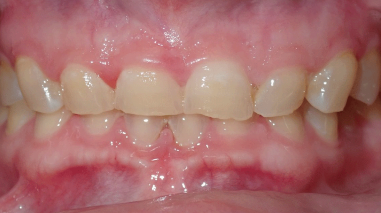 An image of a mouth.
