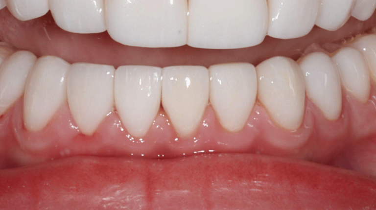 An image of a mouth.