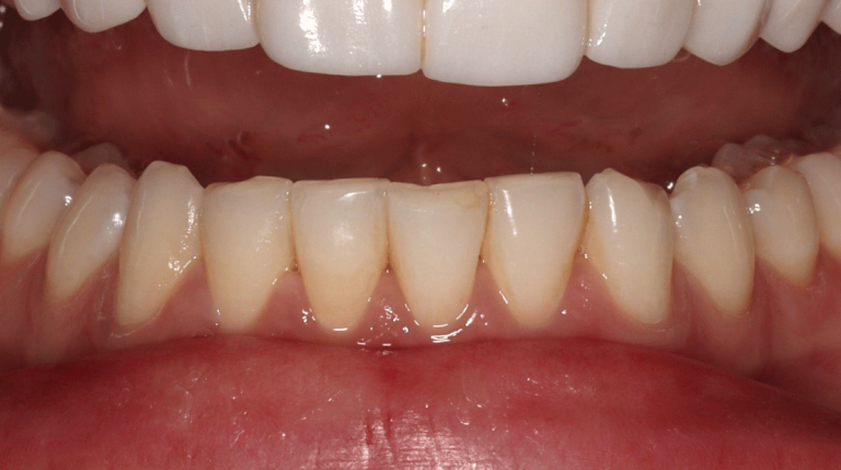 An image of a mouth.