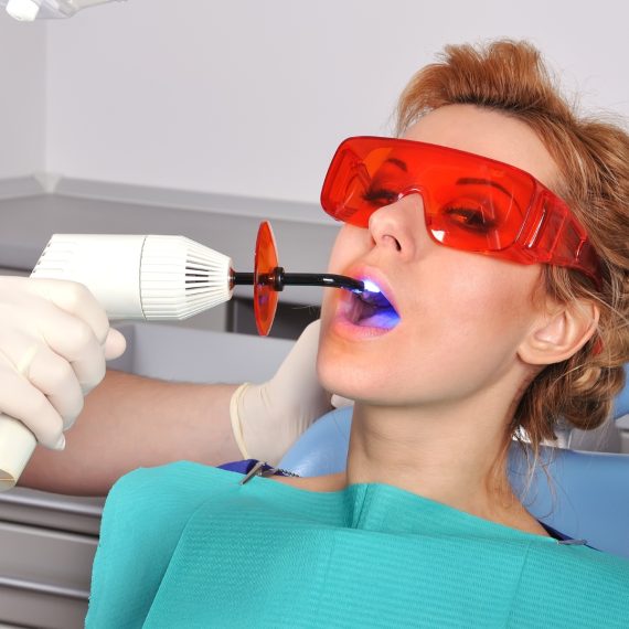 Dental Filling